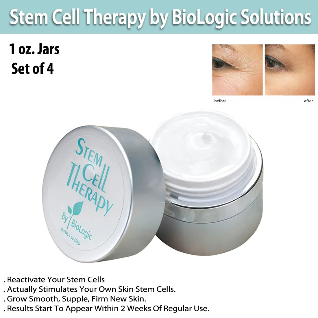 Stem Cell Therapy by BioLogic Solutions (1 oz.) Set of 4